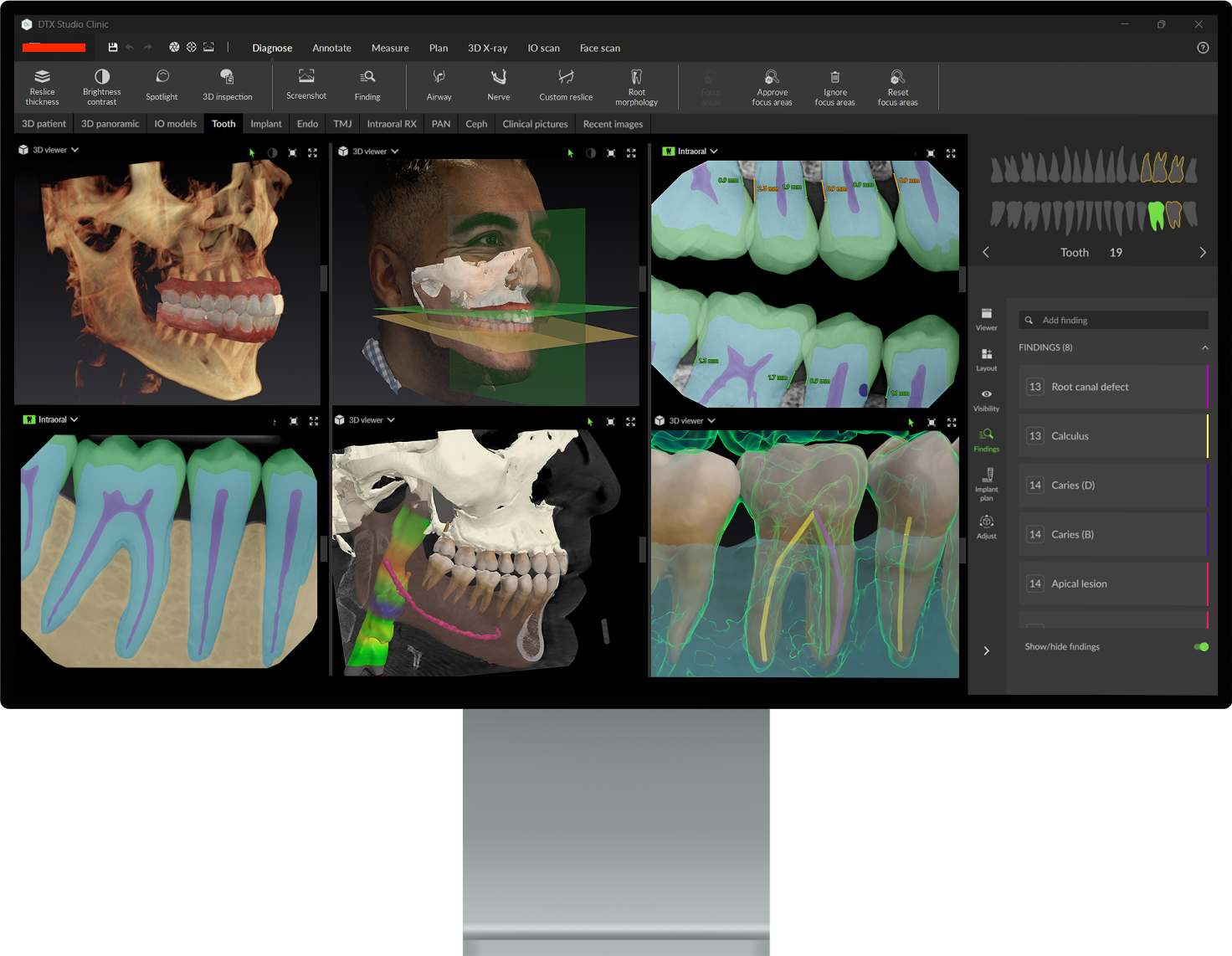 CBCT & Digital X-Rays in Farmington